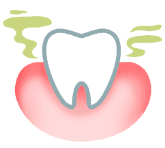  رائحة الفم الكريهة