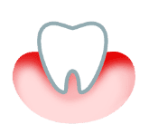  اللثة حساسية