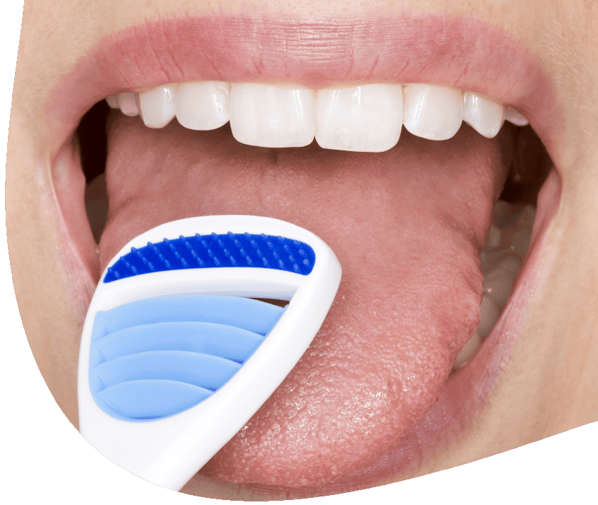 Tongue cleaner