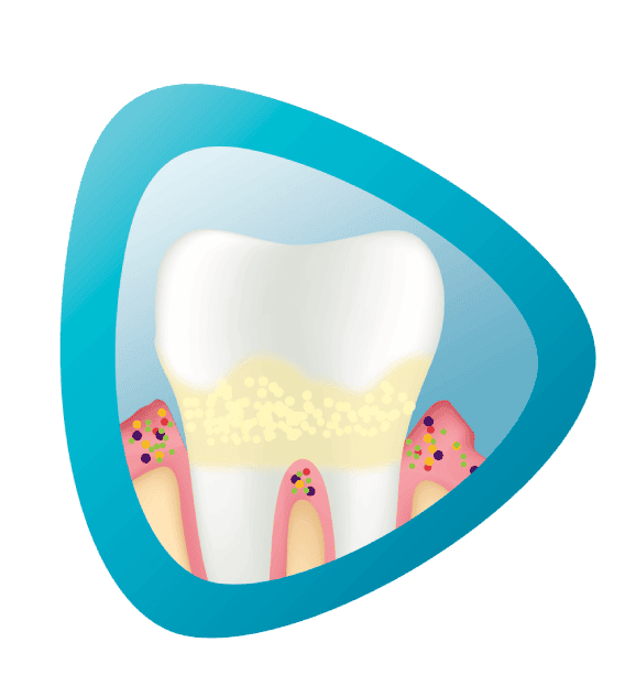 تعرف على مشاكل اللثة