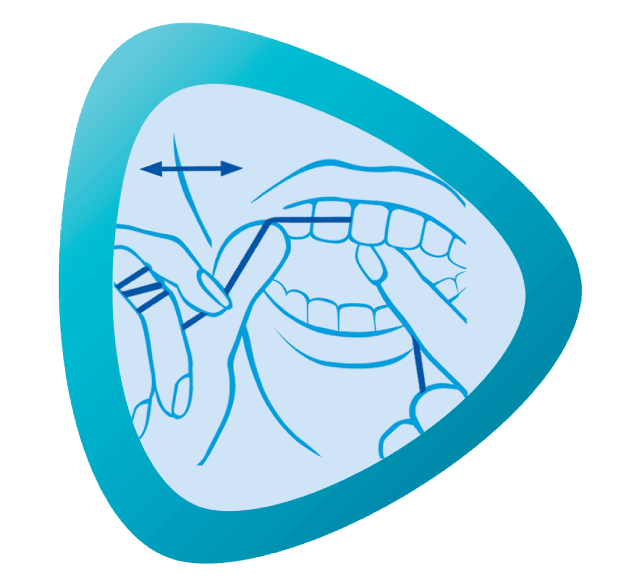 تنظيف الفك العلوي